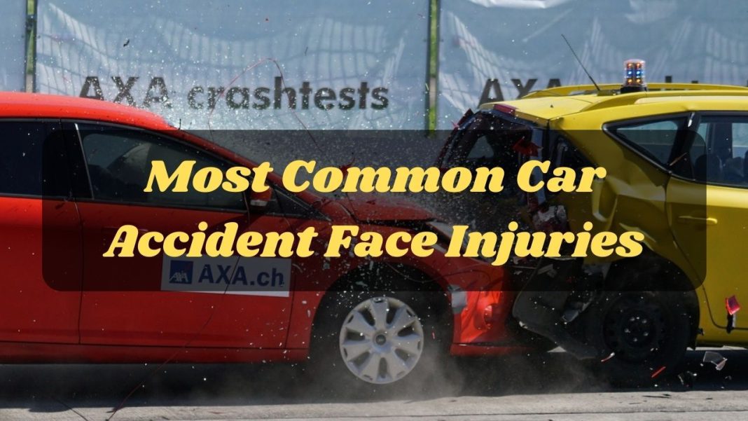 Most Common Car Accident Face Injuries - face trauma swelling treatment